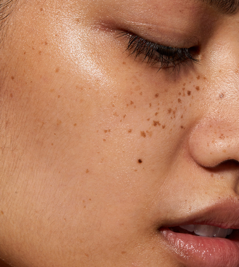 A close up of model's face with Blue Diamond Concentrate applied to her face.