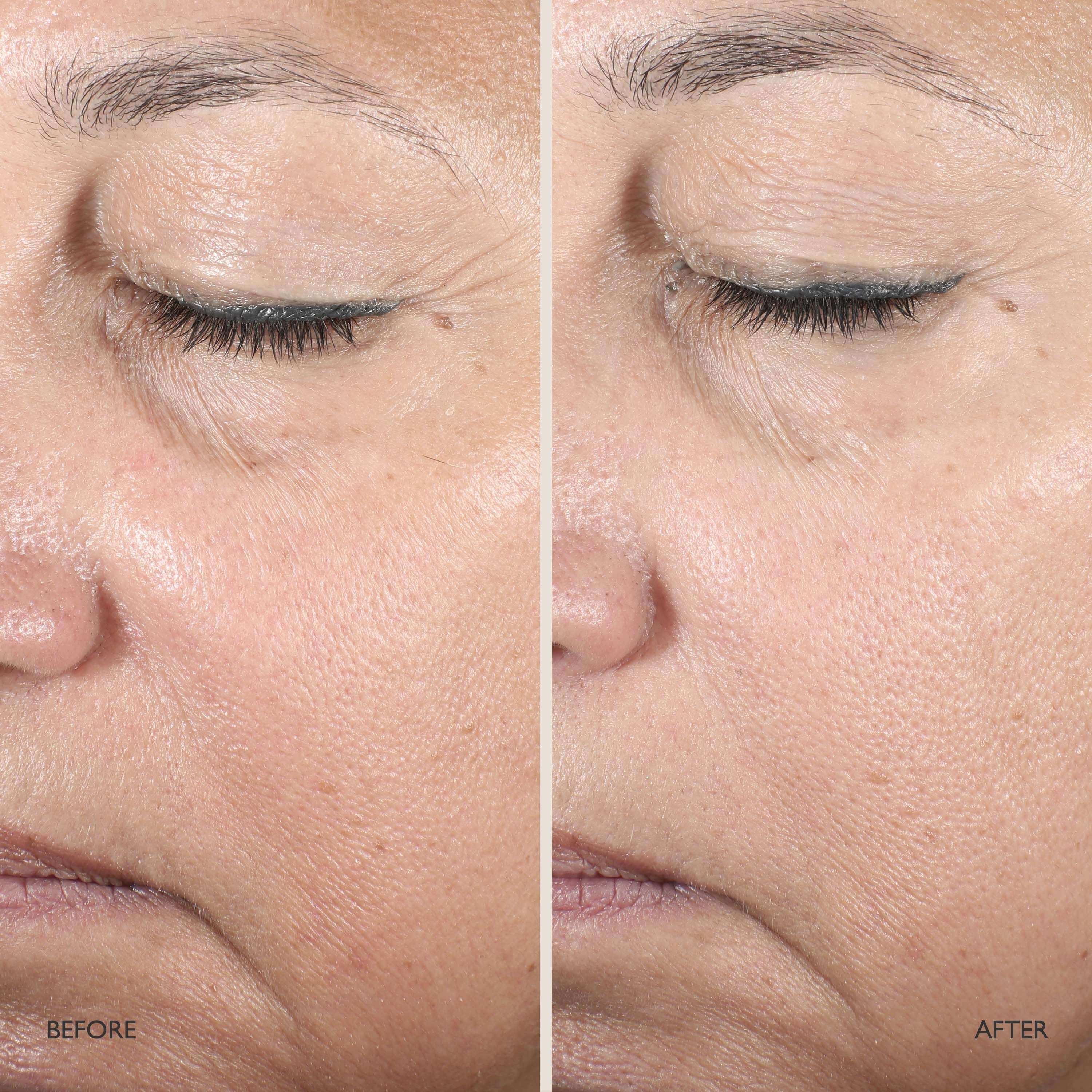 Queen Serum – Omorovicza