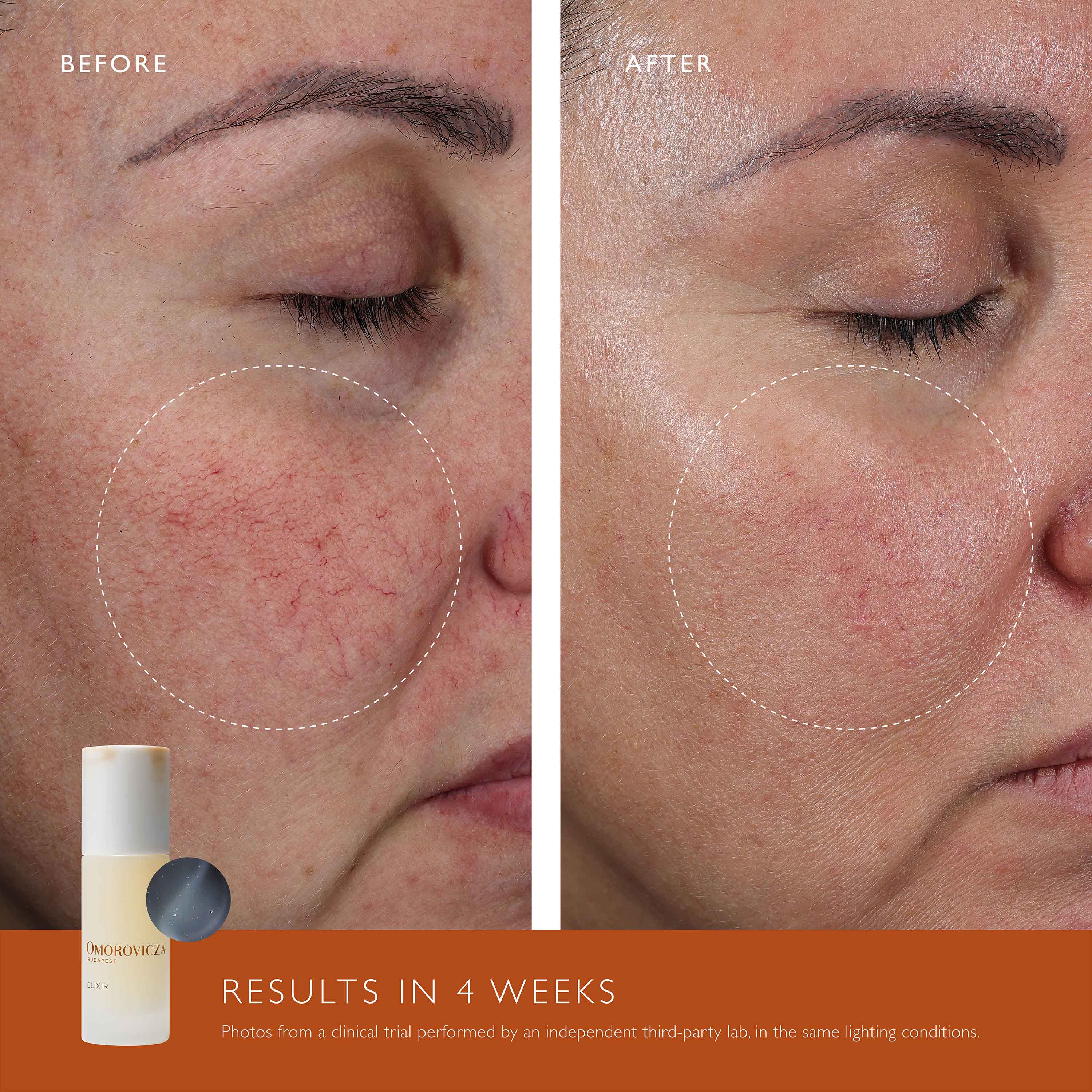 Shop All Skincare I Omorovicza