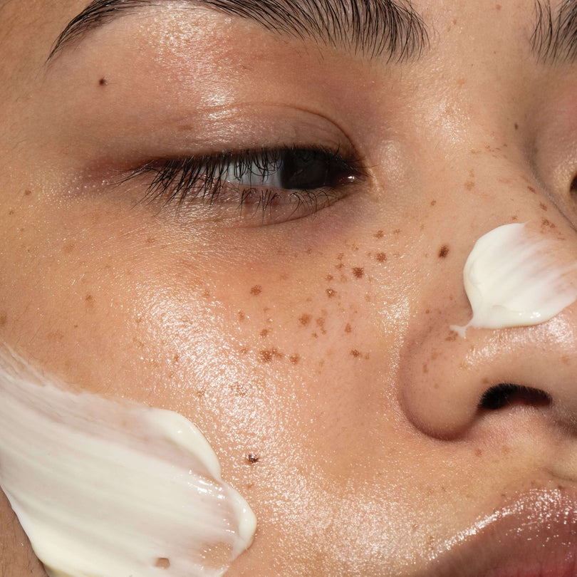 Omorovicza - Dry & Dehydrated Skin